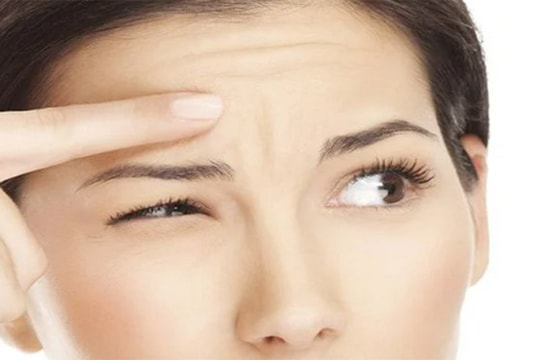 Mẹo làm giảm nếp nhăn trên trán