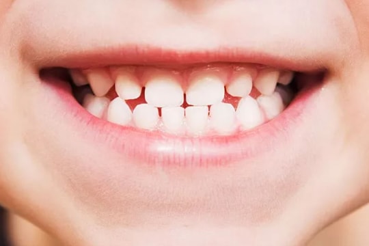 Phát triển loại thuốc giúp răng mọc lại nhiều lần