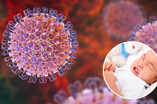 Bệnh do virus ở trẻ và những biểu hiện cha mẹ cần biết