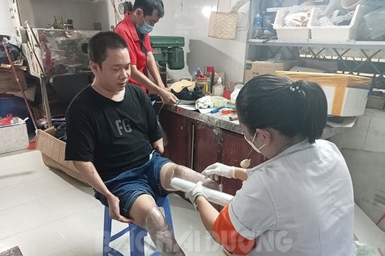 Lắp chân giả miễn phí cho 20 người khuyết tật khó khăn
