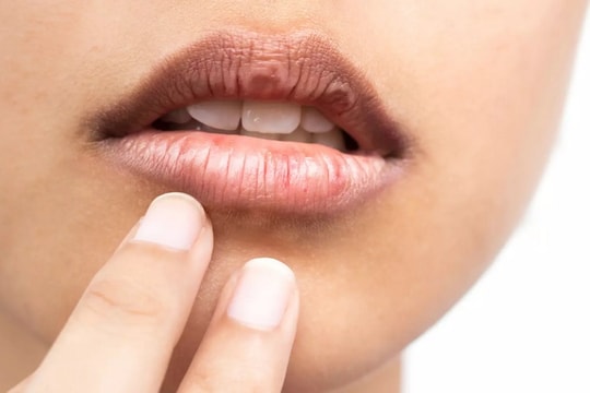 Mẹo chọn son khắc phục môi thâm