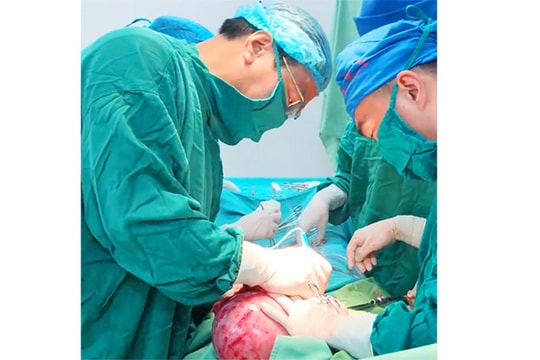 Bệnh viện Phụ sản Hải Dương phẫu thuật lấy khối u xơ tử cung trên 3 kg