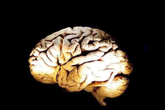 Hy vọng mới về phương pháp điều trị cho các bệnh nhân Alzheimer