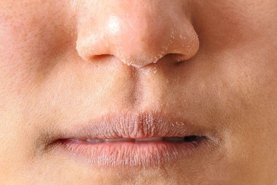 Dưỡng ẩm cho da khi mùa hanh khô