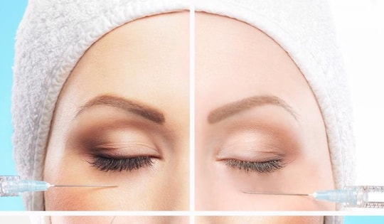Chuyện gì xảy ra khi tiêm filler 6 tháng/lần?