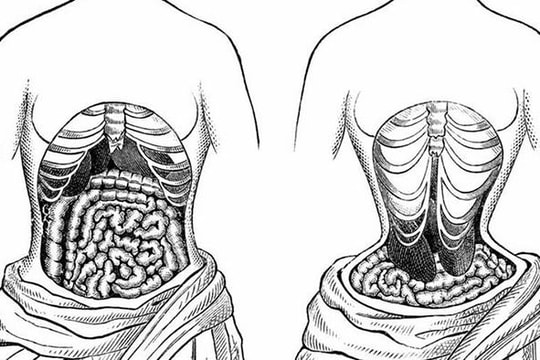 5 tác hại khi siết eo bằng đai nịt bụng