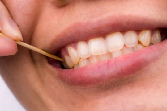 Vì sao không nên dùng tăm xỉa răng?