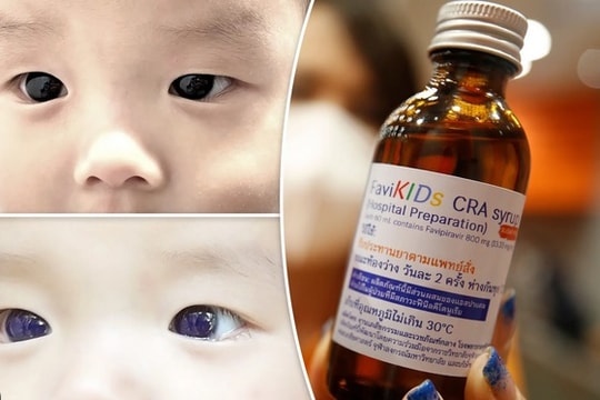Mắt bé sơ sinh chuyển màu xanh sau khi dùng thuốc điều trị Covid-19