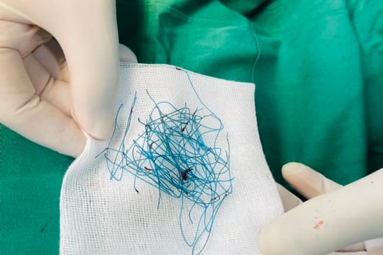 Hiểm hoạ từ trào lưu "nâng mũi chỉ" quảng cáo trên mạng
