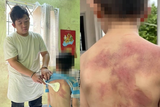 Bắt người cha tàn nhẫn, nhiều lần bạo hành con trai ruột ở Đồng Nai