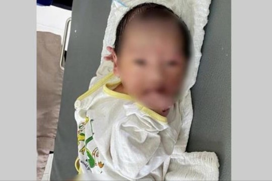 Một bé trai sơ sinh bị bỏ rơi trong ba lô ở Thanh Miện 
