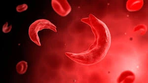 Nước đầu tiên cấp phép liệu pháp gene điều trị bệnh thiếu máu do di truyền