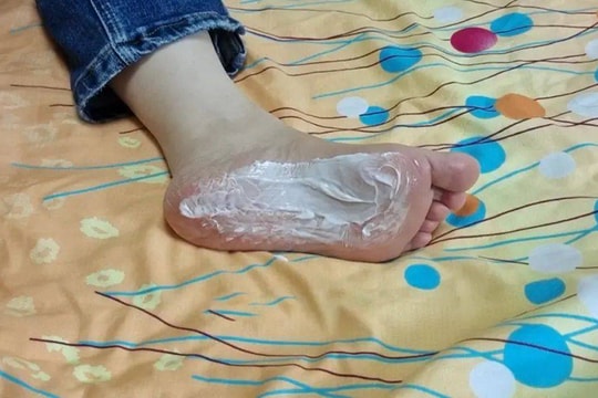 Bảy công dụng không ngờ của kem đánh răng