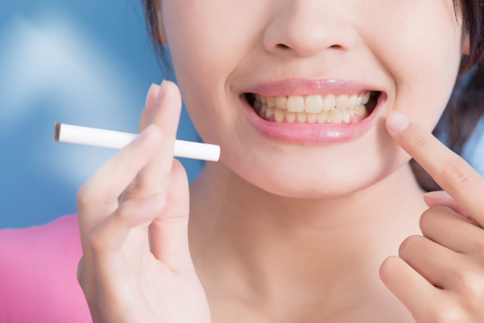 Những thói quen khiến răng bị ố vàng