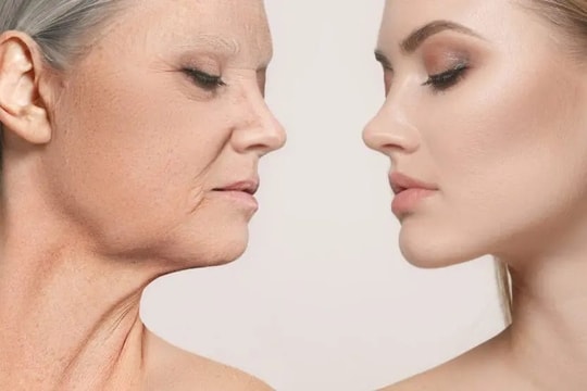 Da mặt chảy xệ khiến bạn già đi 10 tuổi, khắc phục cách nào?