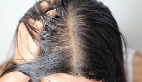 Tóc bết da dầu làm thế nào khắc phục?