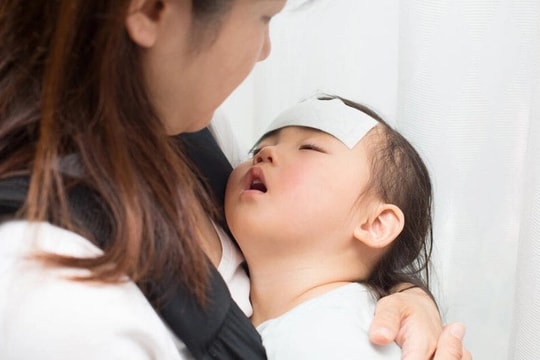 Bé 4 tuổi bị liệt dây thần kinh số 7 do lạnh
