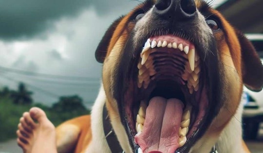 Chó béc giê tấn công bé trai 3 tuổi vỡ thận