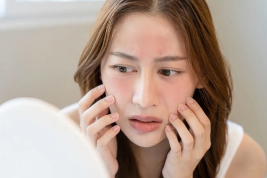 Cách chăm sóc da nhạy cảm vào mùa hè