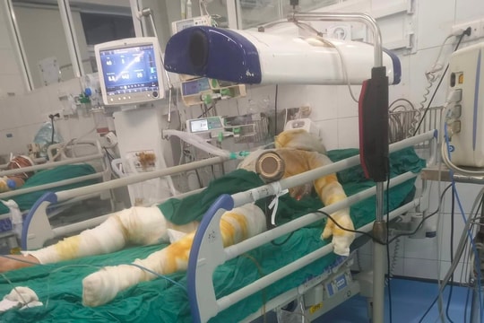 Tang thương cảnh vợ chồng 9X bị bỏng nặng, con gái 19 ngày tuổi tử vong ở Cẩm Giàng
