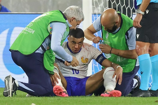 Mbappe suffers broken nose in France's win against Austria