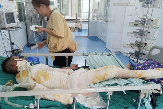 Cháu bé trong vụ cháy ở Quang Thành (Kinh Môn) được ghép da lần thứ 7, phục hồi tốt