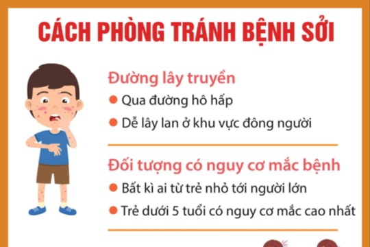 Cách phòng tránh bệnh sởi