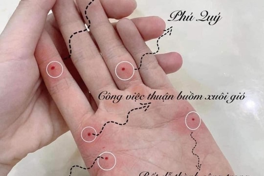 Rủi ro khi xăm nốt ruồi son 'đổi vận' năm mới