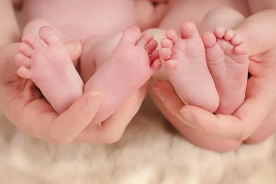 Cặp song sinh đặc biệt chào đời cách nhau 5 tuần ở Hà Nội