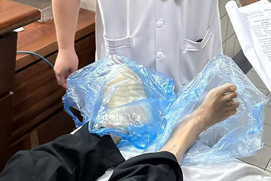 Chân người đàn ông bốc mùi, phải bọc nilon khi vào viện cấp cứu