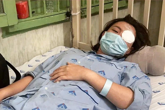 Khởi tố kẻ đánh bạn gái gây thương tích 23% ở quán cà phê
