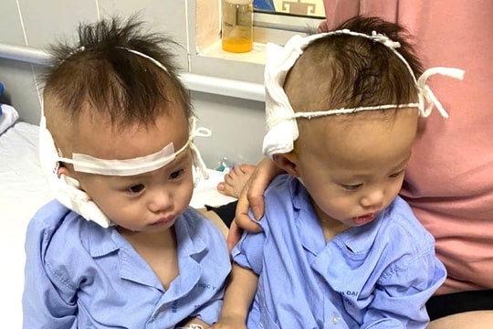 2 bé sinh đôi bị câm điếc ở Thanh Miện đã được hỗ trợ hơn 52 triệu đồng