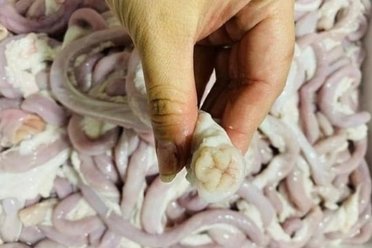 Người phụ nữ bán lòng lợn ở Hà Nội nhiễm liên cầu khuẩn