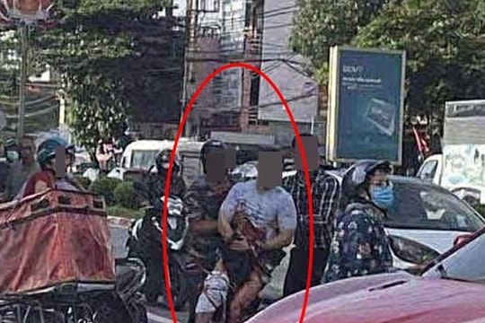 Tiktoker có tiếng ở Thái Nguyên bị chém đứt bàn tay trên đường