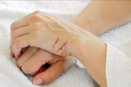 Công nghệ mới giúp tự chữa lành vết thương