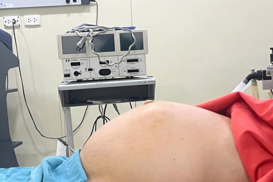 Phẫu thuật cắt khối u xơ tử cung khổng lồ gần 10kg cho bệnh nhân