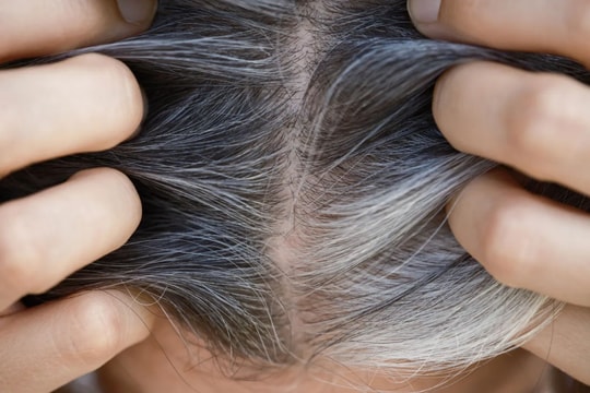 Mối liên quan giữa tóc bạc và nguy cơ ung thư