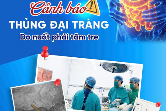 Người đàn ông ở Vĩnh Bảo thủng ruột vì ngậm tăm tre sau bữa ăn