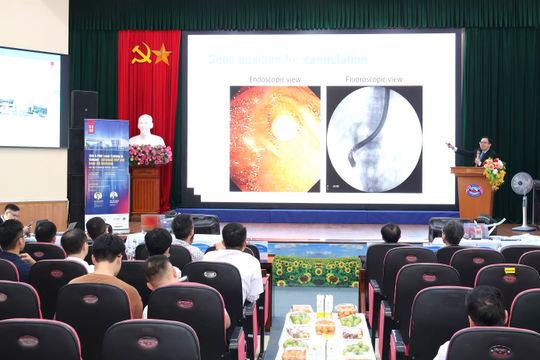 Tiếp cận, cập nhật những tiến bộ mới trong chẩn đoán và điều trị bệnh lý tiêu hoá