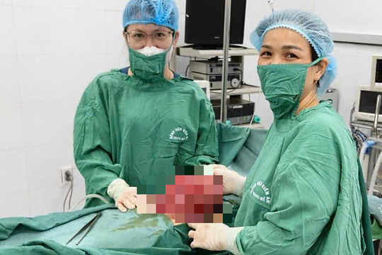 Phẫu thuật u xơ tử cung 3 kg cho bệnh nhân nặng 40 kg
