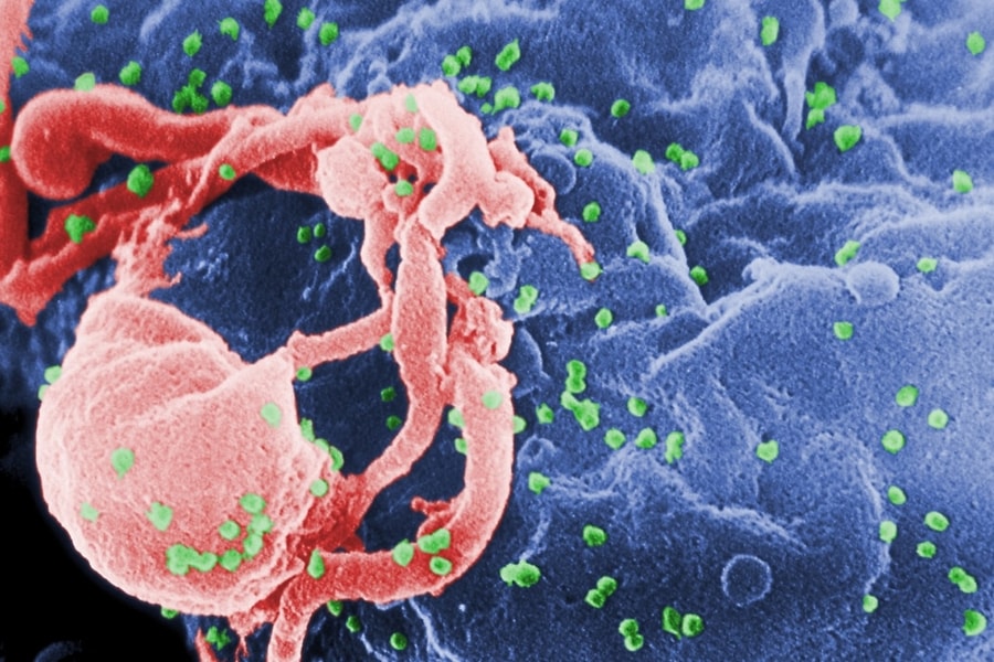 Đột phá khoa học có khả năng chữa khỏi HIV vĩnh viễn