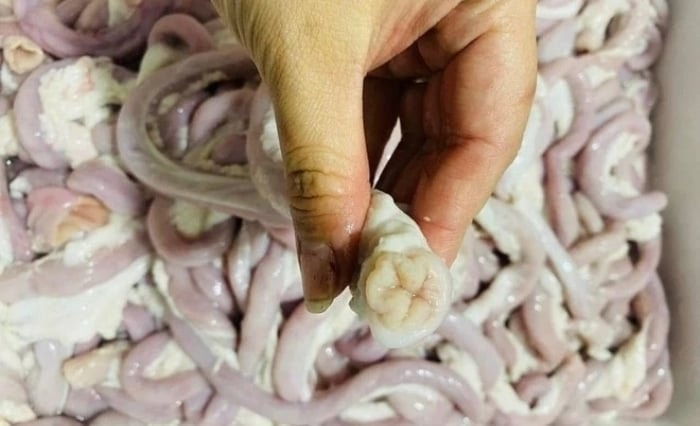 Người phụ nữ bán lòng lợn ở Hà Nội nhiễm liên cầu khuẩn