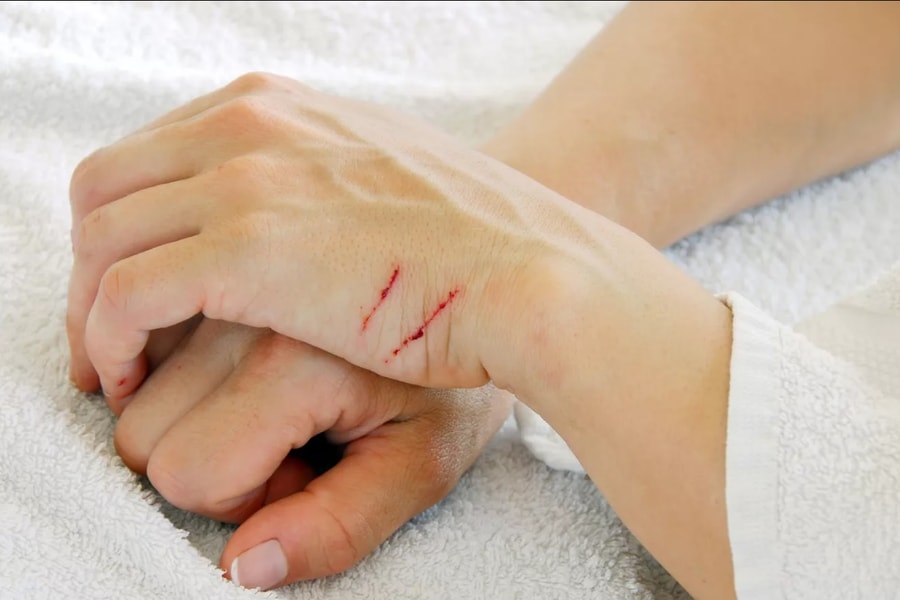 Công nghệ mới giúp tự chữa lành vết thương