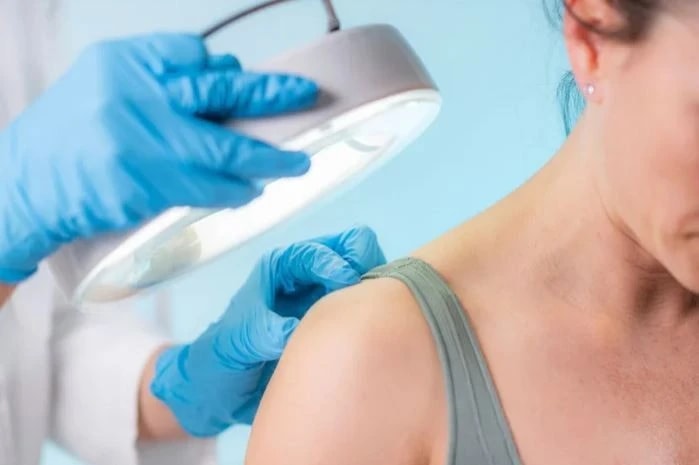 Những dấu hiệu trên da cho thấy bạn đang căng thẳng