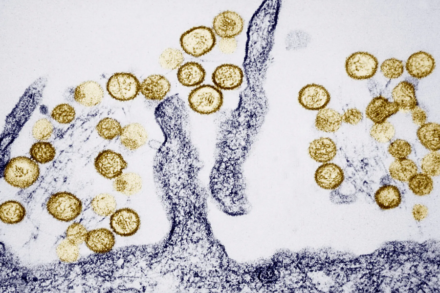 Cảnh giác nhưng không hoang mang trước virus Hanta gây bệnh trên tàu quốc tế